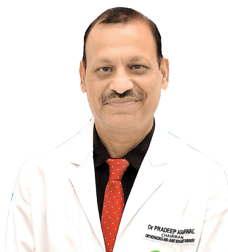Knee replacement hip replacement surgeon in panchkula chandigarh Dr. Pradeep Aggarwal