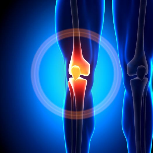 knee replacement surgery in panchkula Dr. Pradeep Aggarwal